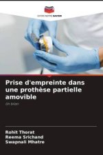 Prise d'empreinte dans une proth?se partielle amovible