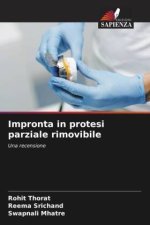 Impronta in protesi parziale rimovibile
