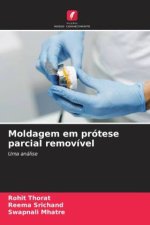 Moldagem em prótese parcial removível