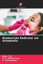 Reabsorç?o Radicular em Ortodontia