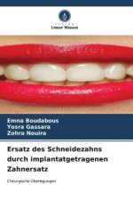 Ersatz des Schneidezahns durch implantatgetragenen Zahnersatz