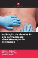 Aplicação da simulação em dermatologia: dermatoscopia do melanoma