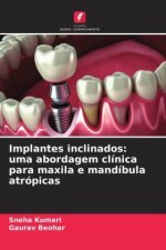 Implantes inclinados: uma abordagem clínica para maxila e mandíbula atrópicas