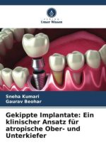Gekippte Implantate: Ein klinischer Ansatz für atropische Ober- und Unterkiefer