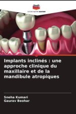 Implants inclinés : une approche clinique du maxillaire et de la mandibule atropiques