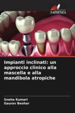 Impianti inclinati: un approccio clinico alla mascella e alla mandibola atropiche