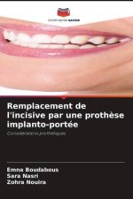 Remplacement de l'incisive par une proth?se implanto-portée
