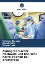 Zymographischer Nachweis und klinische Korrelationen bei Brustkrebs