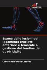 Esame delle lesioni del legamento crociato anteriore e femorale e gestione del tendine del quadricipite
