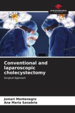 Conventional and laparoscopic cholecystectomy