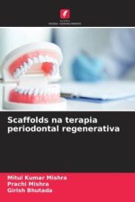 Scaffolds na terapia periodontal regenerativa
