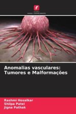 Anomalias vasculares: Tumores e Malformaç?es