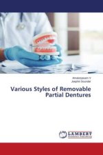 Various Styles of Removable Partial Dentures
