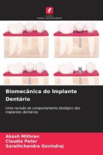Biomecânica do Implante Dentário