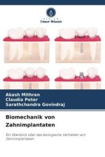 Biomechanik von Zahnimplantaten