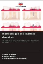 Biomécanique des implants dentaires