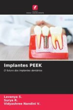 Implantes PEEK