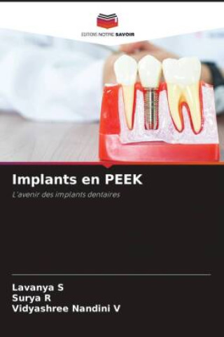 Implants en PEEK