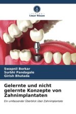 Gelernte und nicht gelernte Konzepte von Zahnimplantaten