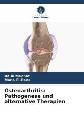 Osteoarthritis: Pathogenese und alternative Therapien