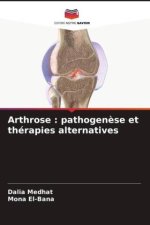 Arthrose : pathogen?se et thérapies alternatives