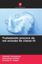 Tratamento precoce da má oclus?o de classe III