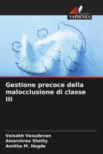 Gestione precoce della malocclusione di classe III