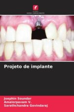 Projeto de implante