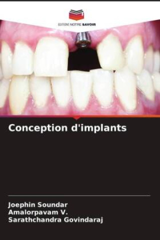 Conception d'implants