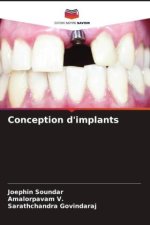 Conception d'implants