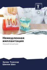 Nemedlennaq implantaciq