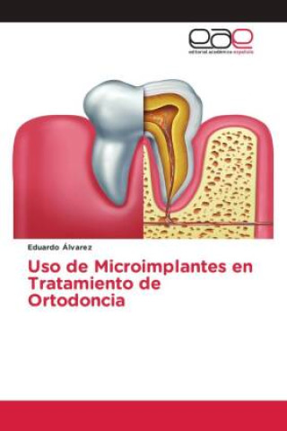 Uso de Microimplantes en Tratamiento de Ortodoncia