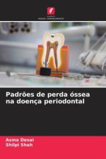 Padr?es de perda óssea na doença periodontal