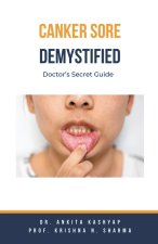 Canker Sore Demystified