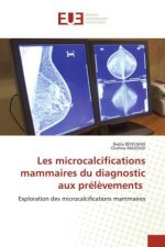 Les microcalcifications mammaires du diagnostic aux prél?vements