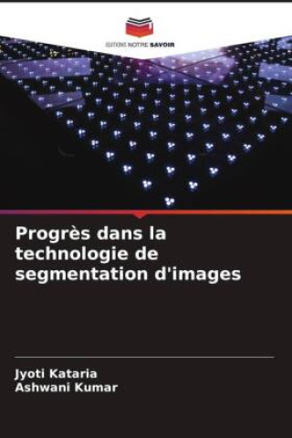 Progrès dans la technologie de segmentation d'images