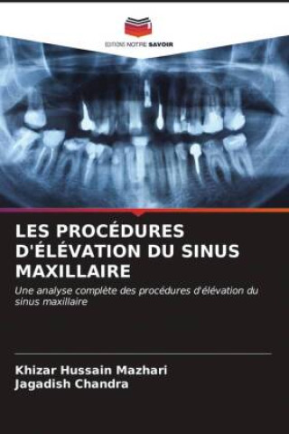 LES PROCÉDURES D'ÉLÉVATION DU SINUS MAXILLAIRE