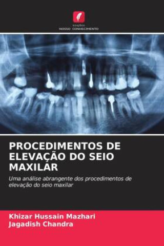 PROCEDIMENTOS DE ELEVAÇÃO DO SEIO MAXILAR