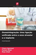Osseointegraç?o: Uma ligaç?o unificada entre o osso alveolar e o implante