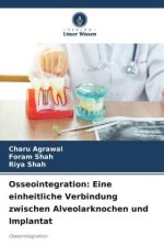 Osseointegration: Eine einheitliche Verbindung zwischen Alveolarknochen und Implantat