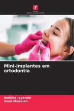 Mini-implantes em ortodontia