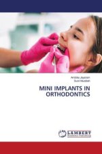 MINI IMPLANTS IN ORTHODONTICS