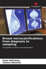 Breast microcalcifications: from diagnosis to sampling