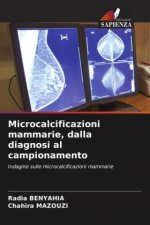 Microcalcificazioni mammarie, dalla diagnosi al campionamento