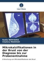Mikrokalzifikationen in der Brust von der Diagnose bis zur Probenentnahme
