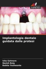 Implantologia dentale guidata dalle protesi