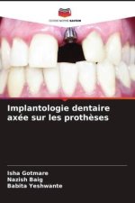 Implantologie dentaire axée sur les prothèses