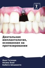 Dental'naq implantologiq, osnowannaq na protezirowanii