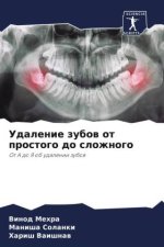 Udalenie zubow ot prostogo do slozhnogo