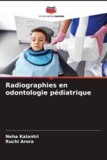 Radiographies en odontologie pédiatrique